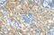 Indian Hedgehog Signaling Molecule antibody, ARP45230_T100, Aviva Systems Biology, Immunohistochemistry frozen image 