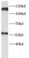 ERCC Excision Repair 4, Endonuclease Catalytic Subunit antibody, FNab10526, FineTest, Western Blot image 