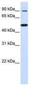 Rhomboid 5 Homolog 1 antibody, TA338604, Origene, Western Blot image 