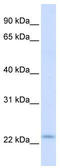 Receptor Accessory Protein 1 antibody, TA338628, Origene, Western Blot image 