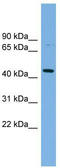 CD112 antibody, TA342534, Origene, Western Blot image 