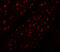 Ribosomal Oxygenase 2 antibody, 5617, ProSci Inc, Immunofluorescence image 