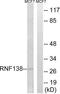 E3 ubiquitin-protein ligase RNF138 antibody, LS-C119937, Lifespan Biosciences, Western Blot image 