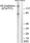 Cadherin 5 antibody, TA313597, Origene, Western Blot image 