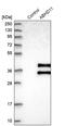 Abhydrolase Domain Containing 11 antibody, PA5-54962, Invitrogen Antibodies, Western Blot image 