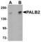 Partner And Localizer Of BRCA2 antibody, TA306814, Origene, Western Blot image 