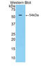 Trefoil Factor 3 antibody, LS-C374201, Lifespan Biosciences, Western Blot image 