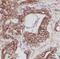 Leucyl-tRNA synthetase, cytoplasmic antibody, FNab04701, FineTest, Immunohistochemistry paraffin image 