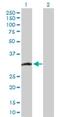 Copper Chaperone For Superoxide Dismutase antibody, H00009973-D01P, Novus Biologicals, Western Blot image 