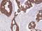Keratin, type II cytoskeletal 8 antibody, 108772-T08, Sino Biological, Immunohistochemistry paraffin image 