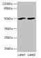 Spermatogenic leucine zipper protein 1 antibody, CSB-PA887147LA01HU, Cusabio, Western Blot image 