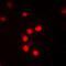 p65 antibody, LS-C358296, Lifespan Biosciences, Immunofluorescence image 