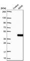 Alcohol dehydrogenase class-3 antibody, HPA044578, Atlas Antibodies, Western Blot image 
