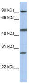 Centromere Protein I antibody, TA334413, Origene, Western Blot image 