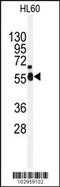 NIMA Related Kinase 2 antibody, 63-380, ProSci, Western Blot image 