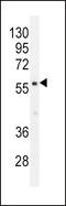 Calcium/calmodulin-dependent 3 ,5 -cyclic nucleotide phosphodiesterase 1B antibody, LS-C163467, Lifespan Biosciences, Western Blot image 