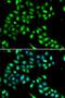 TRNA Methyltransferase 9B (Putative) antibody, LS-C346391, Lifespan Biosciences, Immunofluorescence image 