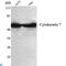Keratin 7 antibody, LS-C812932, Lifespan Biosciences, Western Blot image 