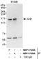 Jouberin antibody, NBP1-78205, Novus Biologicals, Immunoprecipitation image 
