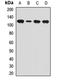 Dynamin 2 antibody, LS-C667774, Lifespan Biosciences, Western Blot image 