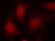 RB Transcriptional Corepressor 1 antibody, NB100-82176, Novus Biologicals, Immunofluorescence image 