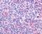 Cholinergic Receptor Muscarinic 4 antibody, NLS220, Novus Biologicals, Immunohistochemistry paraffin image 