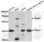 Zinc finger protein RFP antibody, A6405, ABclonal Technology, Western Blot image 