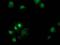 Destrin antibody, MA5-25485, Invitrogen Antibodies, Immunocytochemistry image 