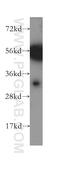 Carbonic Anhydrase 8 antibody, 12391-1-AP, Proteintech Group, Western Blot image 