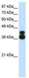 Forkhead Box J1 antibody, TA335194, Origene, Western Blot image 