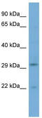 Chromosome 16 Open Reading Frame 78 antibody, TA340336, Origene, Western Blot image 