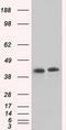 Sterol O-acyltransferase 2 antibody, TA501219, Origene, Western Blot image 