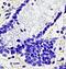 CD28 antibody, orb10295, Biorbyt, Immunohistochemistry paraffin image 