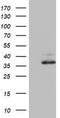 Ornithine Carbamoyltransferase antibody, TA802394S, Origene, Western Blot image 