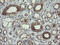 RNA Polymerase III Subunit C antibody, M12992, Boster Biological Technology, Immunohistochemistry paraffin image 