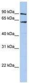 Putative adenosylhomocysteinase 2 antibody, TA332031, Origene, Western Blot image 