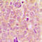 Mitogen-Activated Protein Kinase Kinase Kinase 5 antibody, LS-C368417, Lifespan Biosciences, Immunohistochemistry paraffin image 