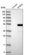BTB Domain Containing 6 antibody, NBP1-88672, Novus Biologicals, Western Blot image 