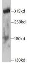 NICD antibody, FNab05798, FineTest, Western Blot image 