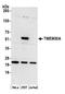 Transmembrane Protein 30A antibody, A305-554A, Bethyl Labs, Western Blot image 