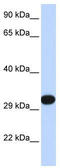 Platelet Derived Growth Factor Subunit B antibody, TA344309, Origene, Western Blot image 