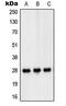 Peroxisomal Biogenesis Factor 11 Beta antibody, MBS822234, MyBioSource, Western Blot image 