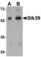 Serine/Threonine Kinase 39 antibody, TA306670, Origene, Western Blot image 