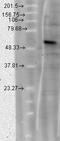 Calcium Voltage-Gated Channel Auxiliary Subunit Beta 4 antibody, LS-C227676, Lifespan Biosciences, Western Blot image 