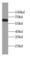 Rho guanine nucleotide exchange factor 25 antibody, FNab03415, FineTest, Western Blot image 