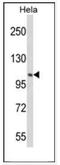 Phosphatidylinositol 4-Kinase Beta antibody, AP17647PU-N, Origene, Western Blot image 