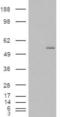 Glucosaminyl (N-Acetyl) Transferase 3, Mucin Type antibody, NB100-93401, Novus Biologicals, Western Blot image 