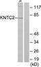 Kntc2 antibody, TA315048, Origene, Western Blot image 