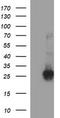 ChaC Glutathione Specific Gamma-Glutamylcyclotransferase 1 antibody, TA507052AM, Origene, Western Blot image 