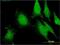 FGF1 Intracellular Binding Protein antibody, H00009158-M01, Novus Biologicals, Immunocytochemistry image 